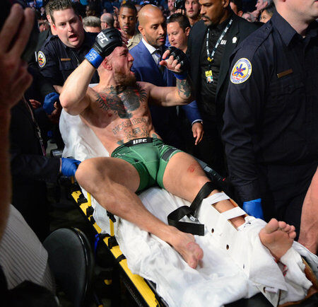 Конор МакГрегор ‘поразил’ Макса Холлоуэя после получения ужасной травмы в их раннем бою в UFC